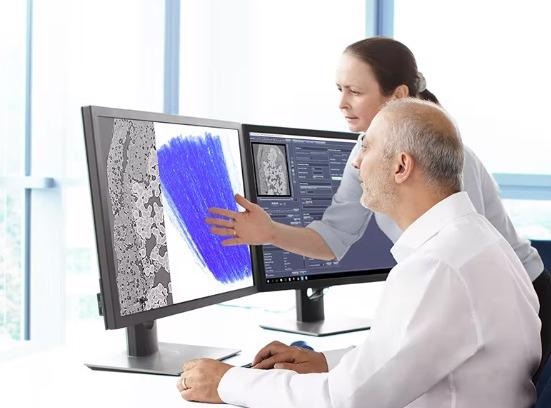 ZEISS OptiRecon for Iterative Reconstruction